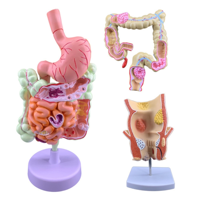 Medical Lab Observer - Q6PA 3D-модель обучения патологии, анатомический дисплей